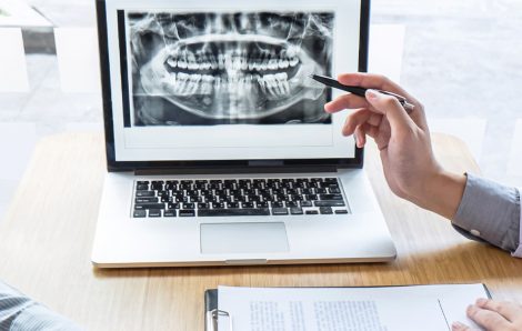 Everything You Should Know About Digital Radiography?